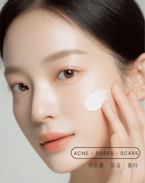 여드름/모공/흉터